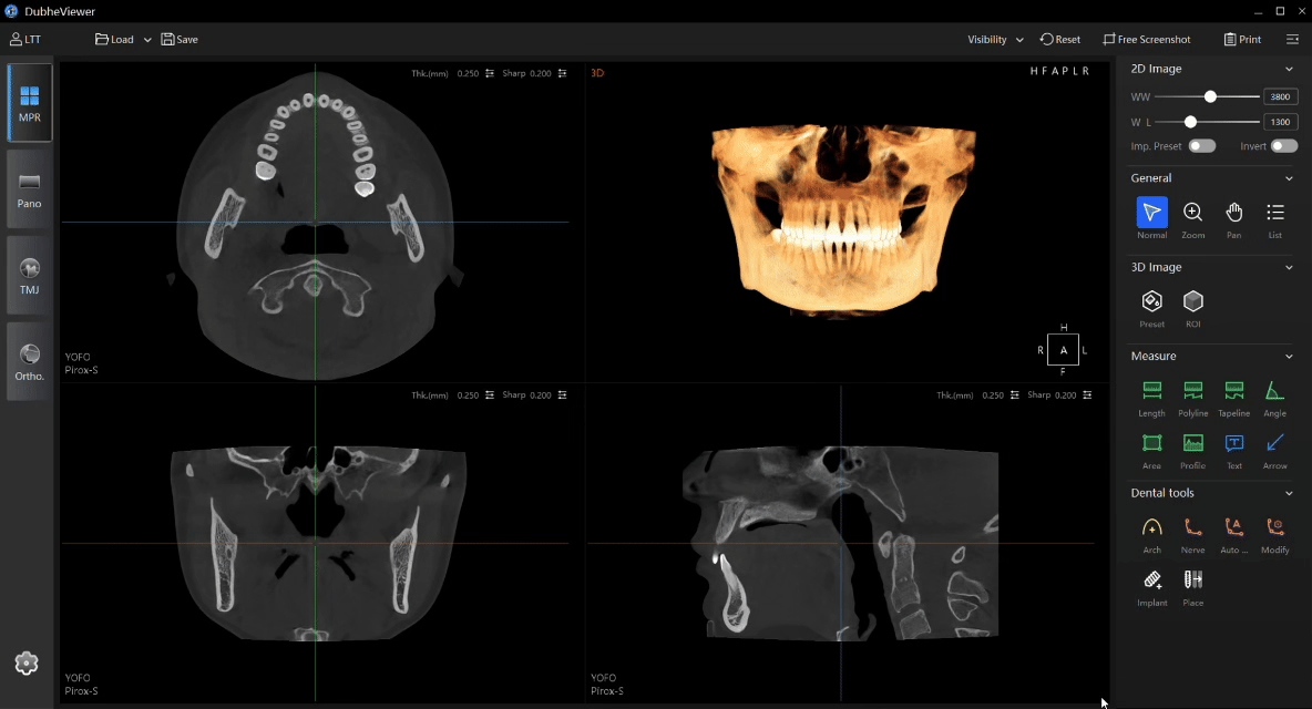 YOFO instant multi-planar navigation interface